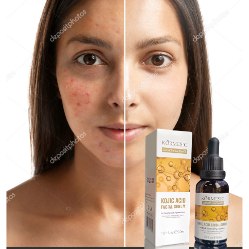 SERUM FACIAL  con Niacinamida de Kormesic